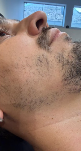 Antes do procedimento
